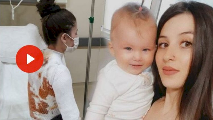 Ailədə dəhşət: Kişi arvadının üzərinə qaynar su tökdü