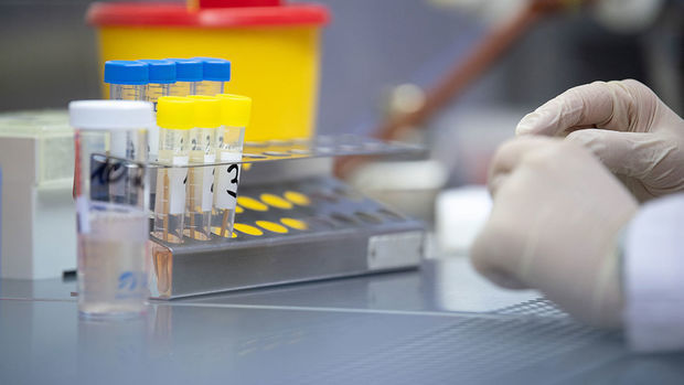 Azərbaycanda daha 15 nəfər koronavirusdan öldü: 402 yeni yoluxma - FOTO