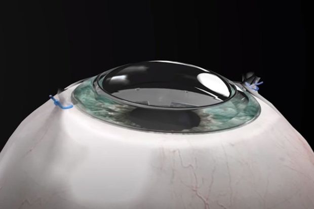 Ученые смогли за сутки восстановить зрение у слепого пациента