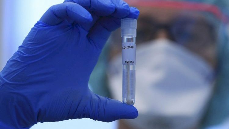 Gürcüstanda son sutkada 298 nəfər COVID-19-a yoluxub