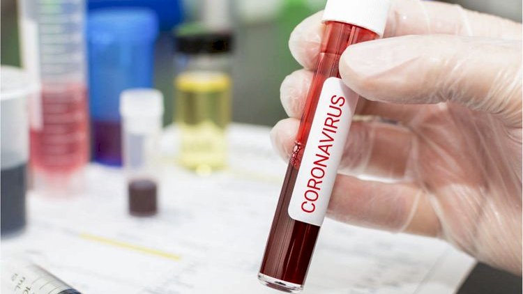 Ermənistanda koronavirusdan ölənlərin sayı 3047 nəfərə çatıb