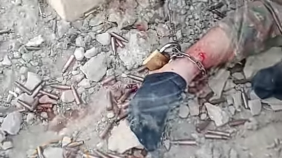 Erməni əsgərinin ayağında 300 metrlik ZƏNCİR... - Hərbçimiz gördüklərindən DANIŞDI