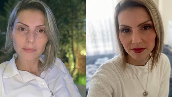 35 yaşlı Arzunu TİKƏ-TİKƏ DOĞRAYIB, salafana BÜKDÜLƏR