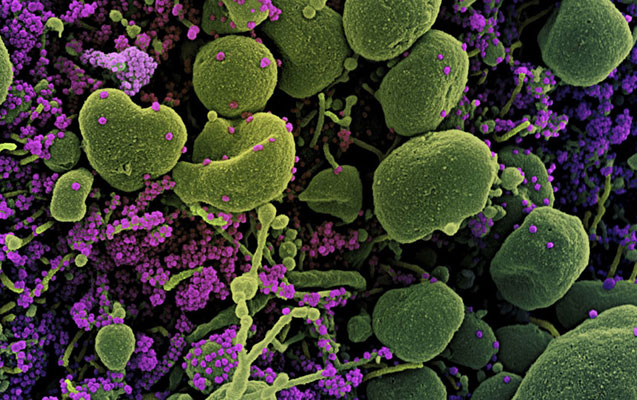 “Britaniya ştammı” da mutasiyaya uğradı