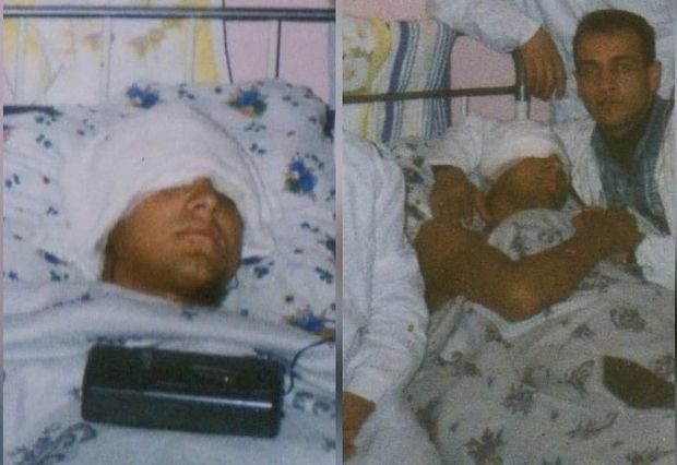 Ильхам Закиев поделился снимками, сделанными 12 лет назад после ранения - ФОТО