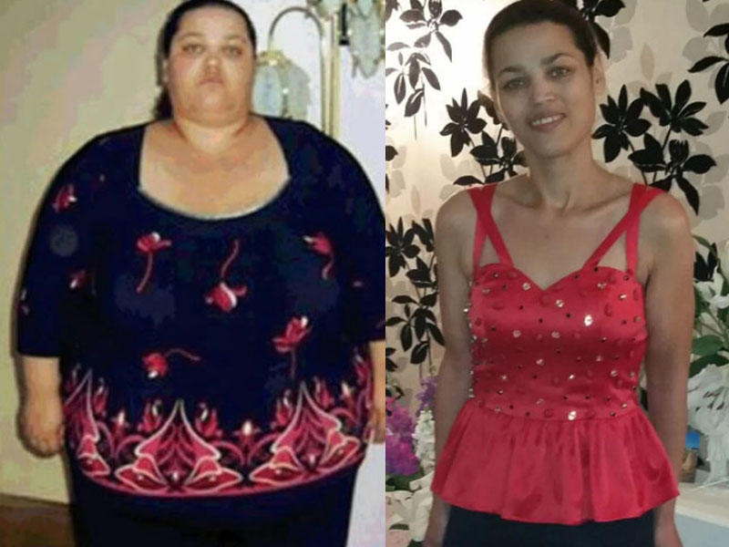 120 kiloqram arıqladı, intihara cəhd etdi - FOTO