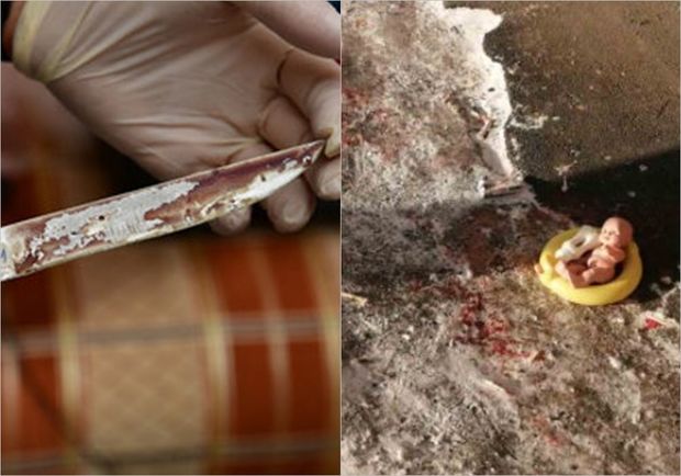 Sərxoş qadın iki yaşlı nəvəsini bıçaqladı - FOTO/VİDEO