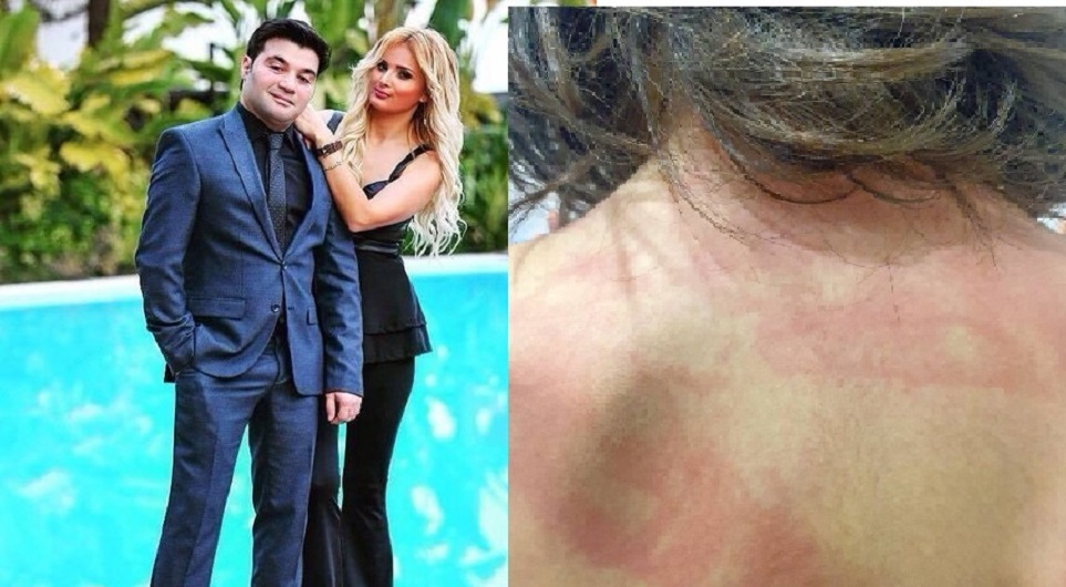 Əməkdar artistin gəlini qızının işgəncəyə məruz qaldığını iddia edir - FOTO