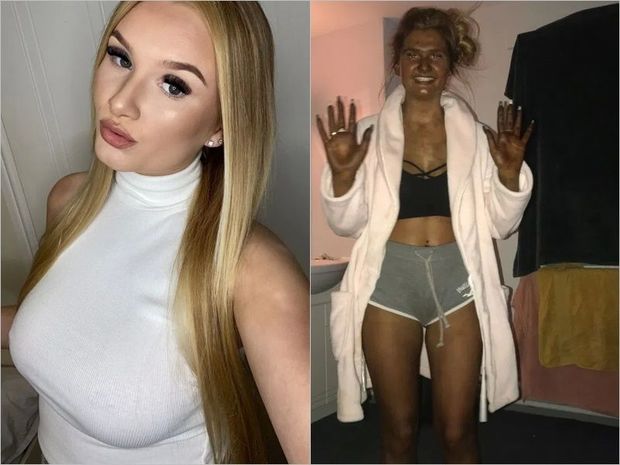 Saxta krem dərisinin rəngini yaşıla çevirdi - FOTO/VİDEO