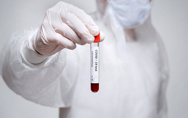 Türkiyədə koronavirusla bağlı son vəziyyət