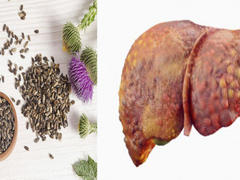 Azərbaycanda 53 yaşlı kişi Hepatit B virusundan bu bitki ilə sağaldı – Möcüzə pasiyent hekayəsi