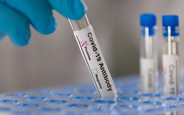 Son sutkada koronavirusdan ölənlərin sayı artdı