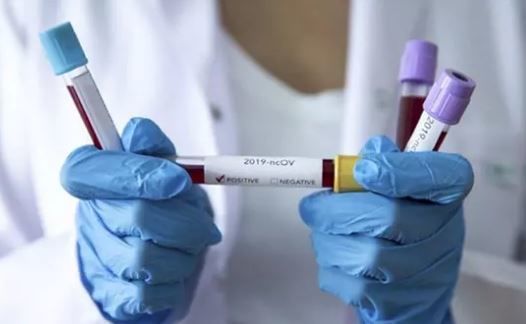 Türkiyədə son koronavirus statistikası açıqlandı – FOTO
