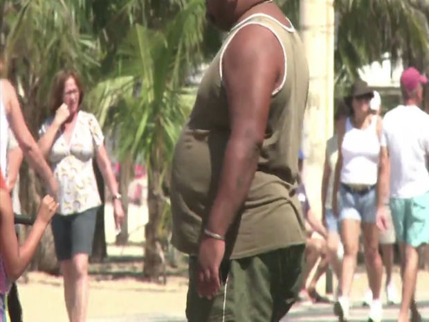 COVID-19: Artıq çəki risk faktorudur - VİDEO