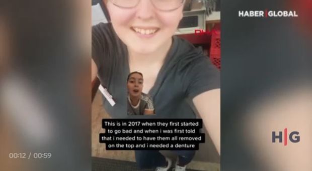 Qazlı içkilər səbəbindən dişlərini itirdi – VİDEO