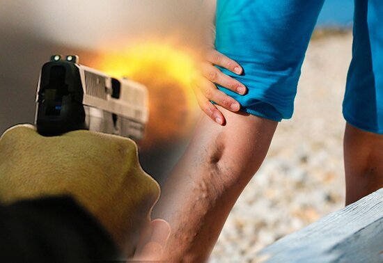 30 yaşlı evli kişi sevgilisinin sifarişi ilə SİLAHLA VURULDU - FOTOLAR