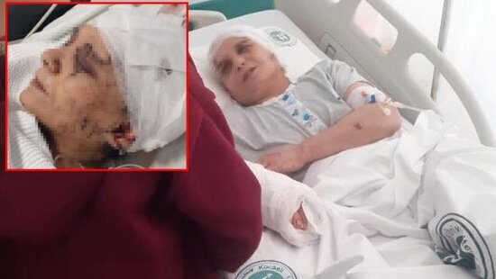 Kişi BALTA İLƏ arvadının başını, barmağını və qulağını KƏSDİ - ŞOK SƏBƏB - FOTO