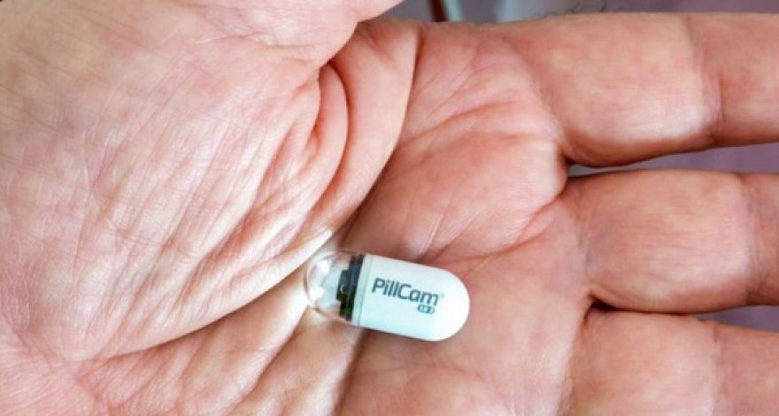 В Британии испытывают капсулы с камерой для ранней диагностики рака кишечника