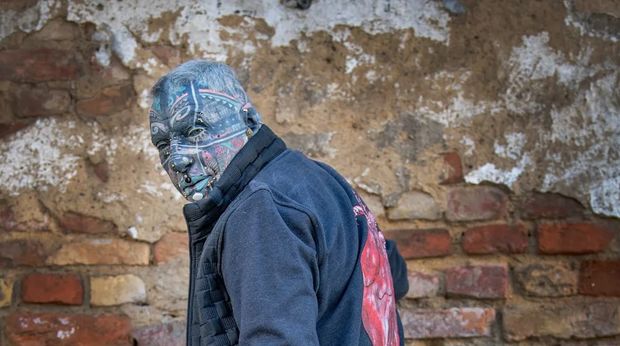 Bədəninin 98 faizi döymə olan təqaüdçü – FOTO