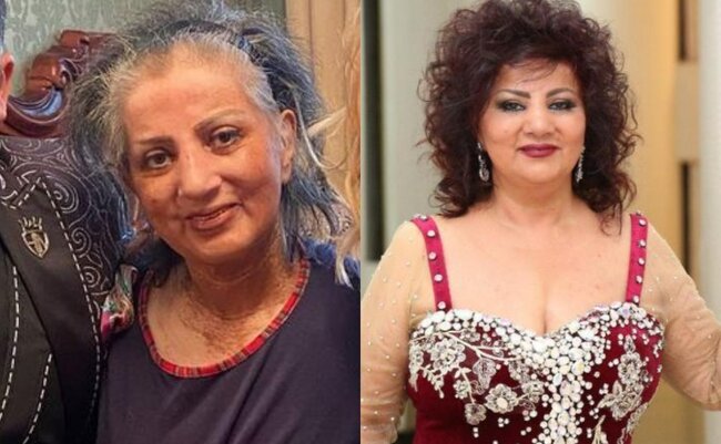 Zöhrə Abdullayeva xəstəxanaya yerləşdirildi - FOTOLAR