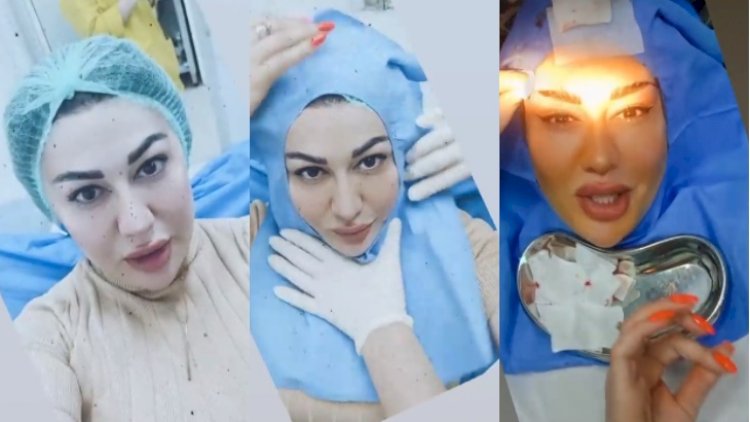 Rəqqasə Fatimə əməliyyat olundu - Görüntülərini paylaşdı + Video