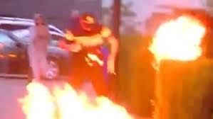 Doğma anası səkkiz yaşlı oğlunu diri-diri yandırdı - FOTO