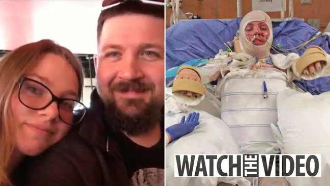 DİRİ-DİRİ yanan 18 yaşlı qızın SON HALI - 18+ FOTOLAR - VİDEO