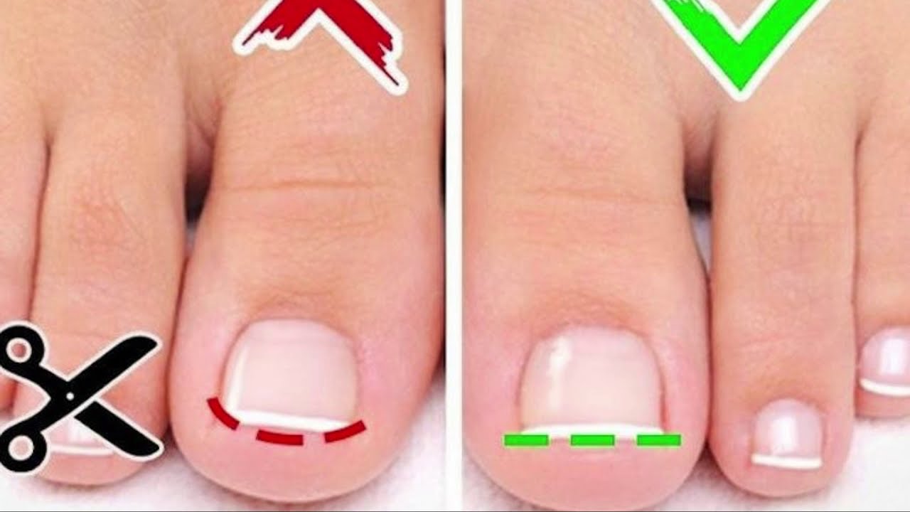 Gecə vaxtı dırnağı niyə kəsmək olmaz? - ŞOK SƏBƏB