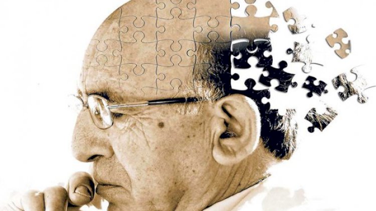 Koronavirusa yoluxan professor yaddaşını itirdi