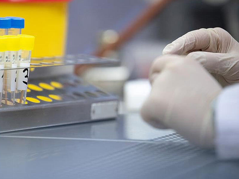 Koronavirusun daha bir ştammı aşkarlandı