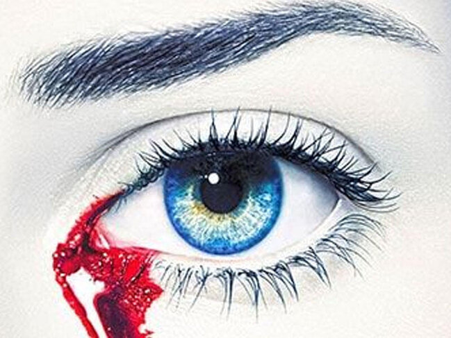 25 yaşlı qız qanlı göz yaşları ilə ağlayır - Unikal hadisə