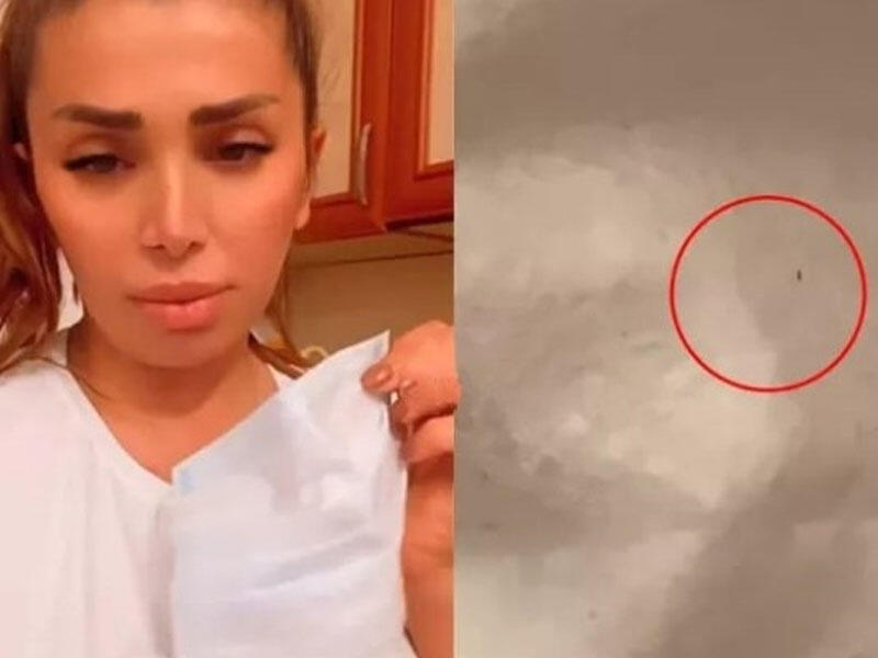 İstifadə etdiyimiz maskalarda qurd var? - VİDEO