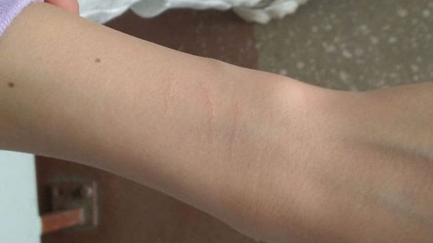 Rusiyada beşinci sinif şagirdləri sosial şəbəkədə videoya baxıb qollarını kəsdilər