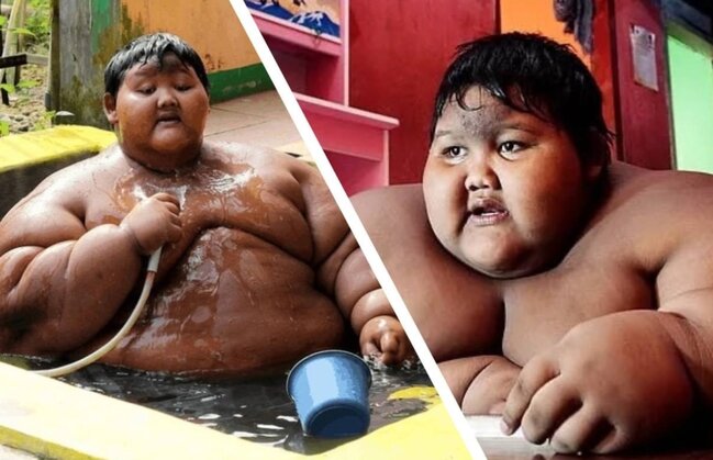 190 kilo çəkisi olan ən ağır uşaq arıqayıb BELƏ OLDU - FOTO