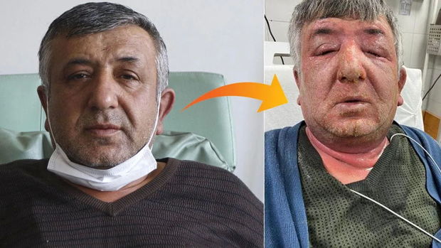 Şübhə taksi sürücüsünü xəstəxanalıq etdi - VİDEO