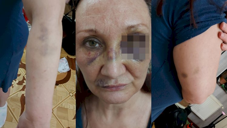 Bakıda futbolçunun qayınanası döyüldü - Fotolar