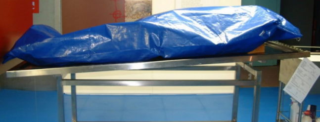 Morqa aparılan uşaq DİRİLDİ