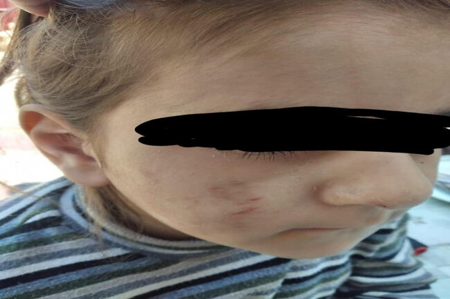 Azərbaycan ailəsində daha bir DƏHŞƏT: Atası döyür, anası isə...