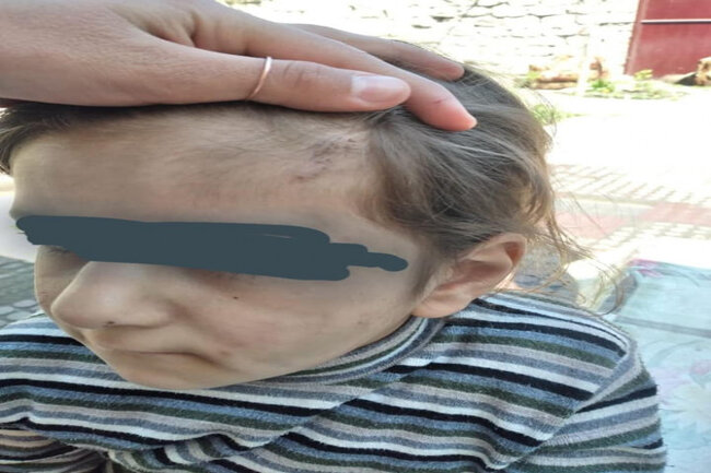 Ailəsi tərəfindən şiddət görən azyaşlı ilə bağlı YENİ XƏBƏR