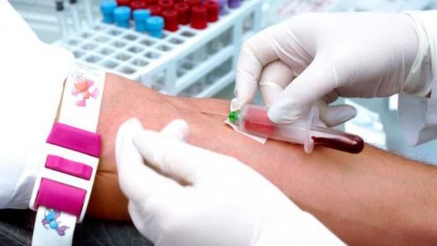 İcbari tibbi sığortaya daxil olan analizlər özəl xəstəxanalarda verilə bilərmi? - AÇIQLAMA