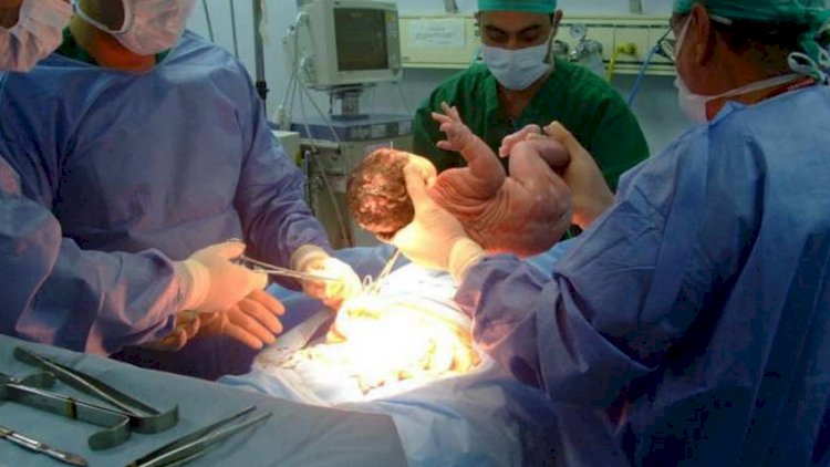 Bakıda əkizlər doğuş zamanı öldü