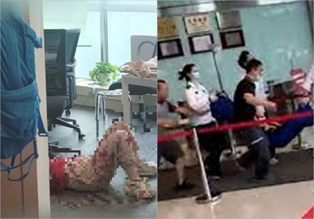 Çində bıçaqlı qadın ətrafında olanlara hücum edib - VİDEO