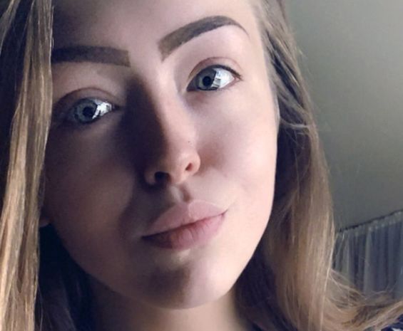 Девушка подхватила смертоносную инфекцию на вечеринке и лишилась ноги