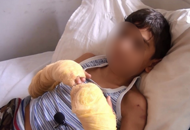 Bərdədə övladının əllərini yandıran qadın barəsində cinayət işi başlanıb