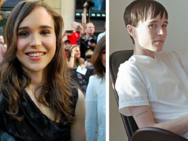 Cinsini dəyişən Hollivud ulduzu əməliyyatdan sonra bədənini nümayiş etdirib - FOTO