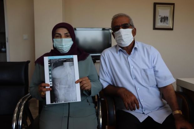 İki ay qarnındakı qayçı ilə yaşadı - FOTO