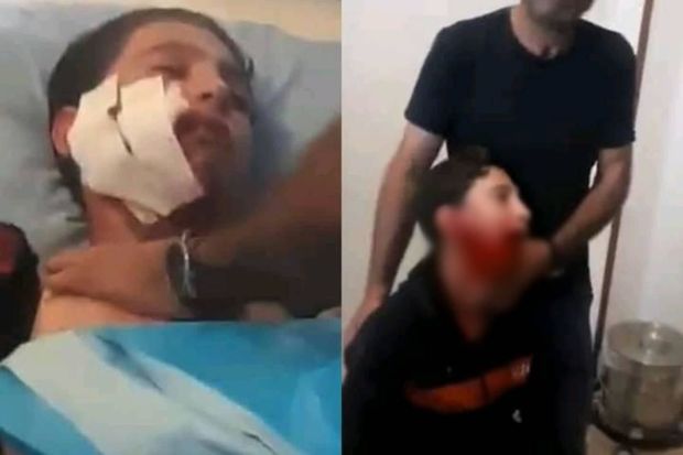 Azərbaycanda dəhşət: Canavar sürüsü şagirdlərə hücum etdi - VİDEO