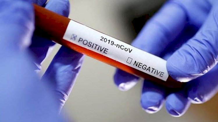 Ermənistanda daha 7 nəfər öldü