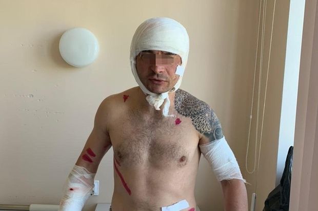 Özünü ölülüyə vurmaqla ayının pəncəsindən xilas oldu - FOTO