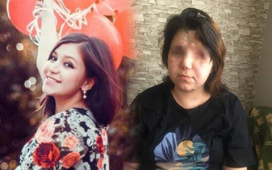 Gəncə terrorunda 2 gözünü itirən Pərvin... - FOTO